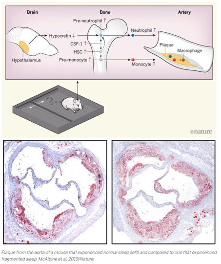 McAlpine et al. Nature 2019 Nature paper showing sleep disruption contributes to cardiovascular disease
