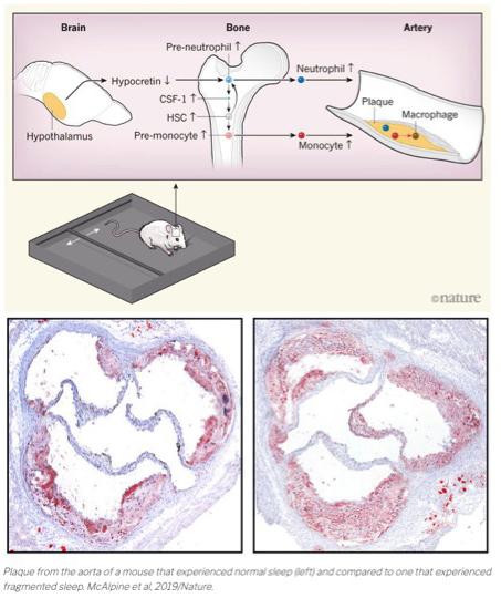 Nature paper showing sleep disruption contributes to cardiovascular disease